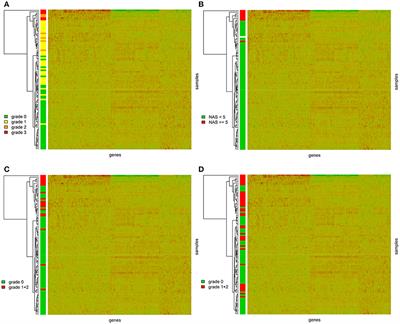 Hepatic Gene Expression Profiles Differentiate Steatotic and Non-steatotic Grafts in Liver Transplant Recipients